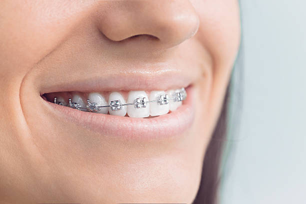 Best Tooth Extraction  in Fairbanks Ranch, CA